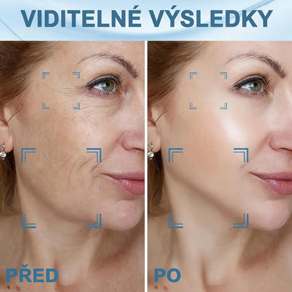 Přístroj s červeným světlem pro zpevnění a omlazení pleti obličeje, krku a paží – navržený speciálně pro zralou ženskou pleť, aby byly kontury hladší a pevnější.